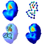 Path Routing Optimization for STM Ultrasound Rendering